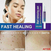 🖊️ Wart Remover Gel Pen Fast & Effective 💨✨