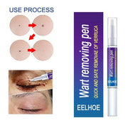🖊️ Wart Remover Gel Pen Fast & Effective 💨✨