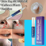 🖊️ Wart Remover Gel Pen Fast & Effective 💨✨